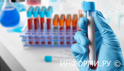 Что показывает анализ ПСА?