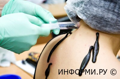 Что такое гирудотерапия и для чего она нужна